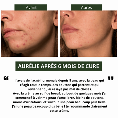BAUME AU SUIF DE BOEUF